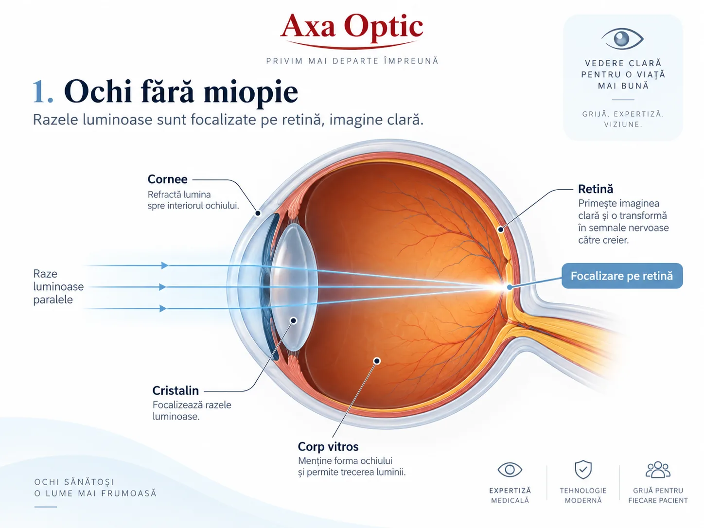 Ochi fără miopie: razele luminoase se focalizează pe retină