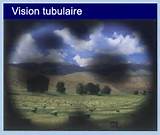 Imagine ilustrativă despre glaucom