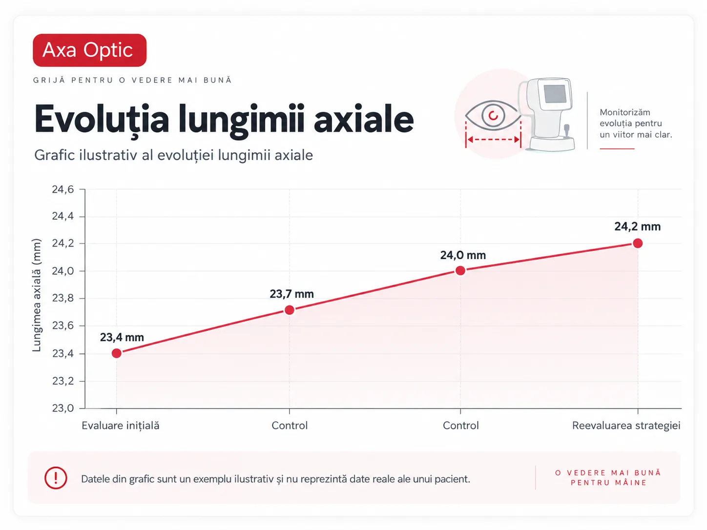 Grafic ilustrativ al evoluției lungimii axiale