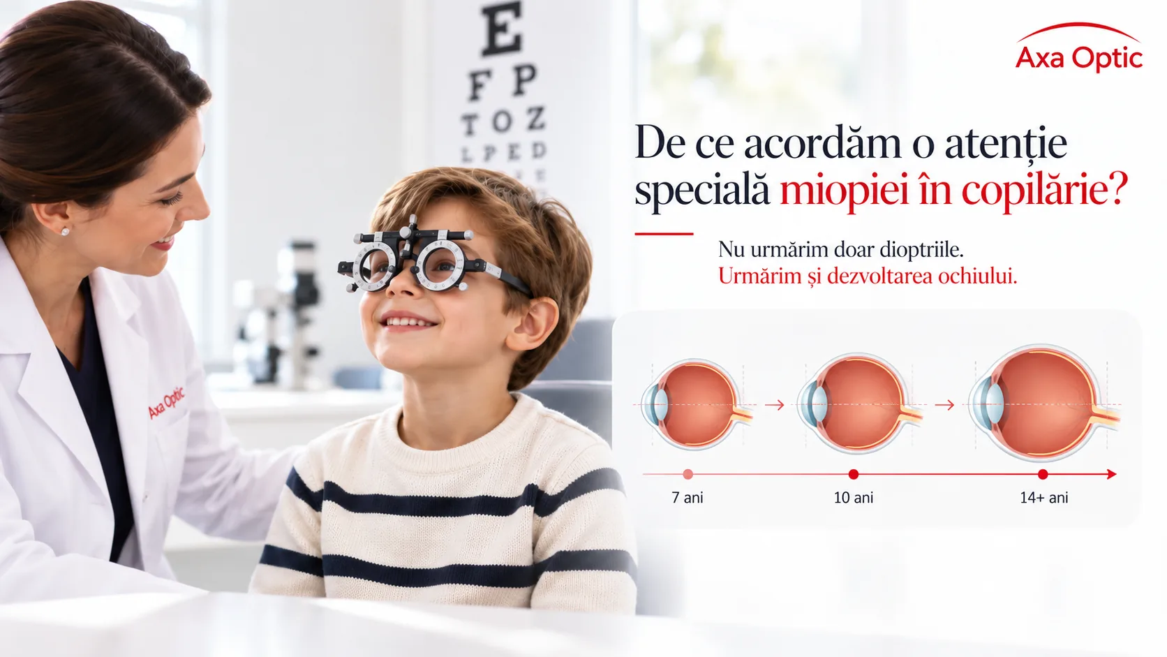 Miopia la copii și dezvoltarea ochiului