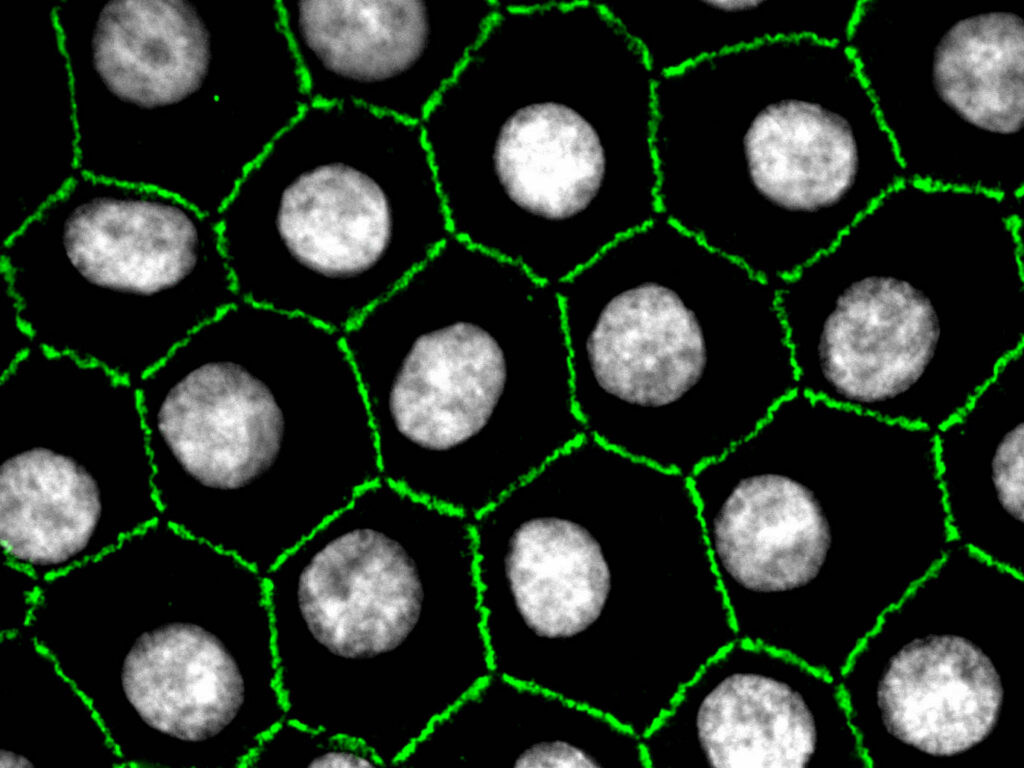 Mozaic de celule endoteliale corneene cu structură predominant hexagonală